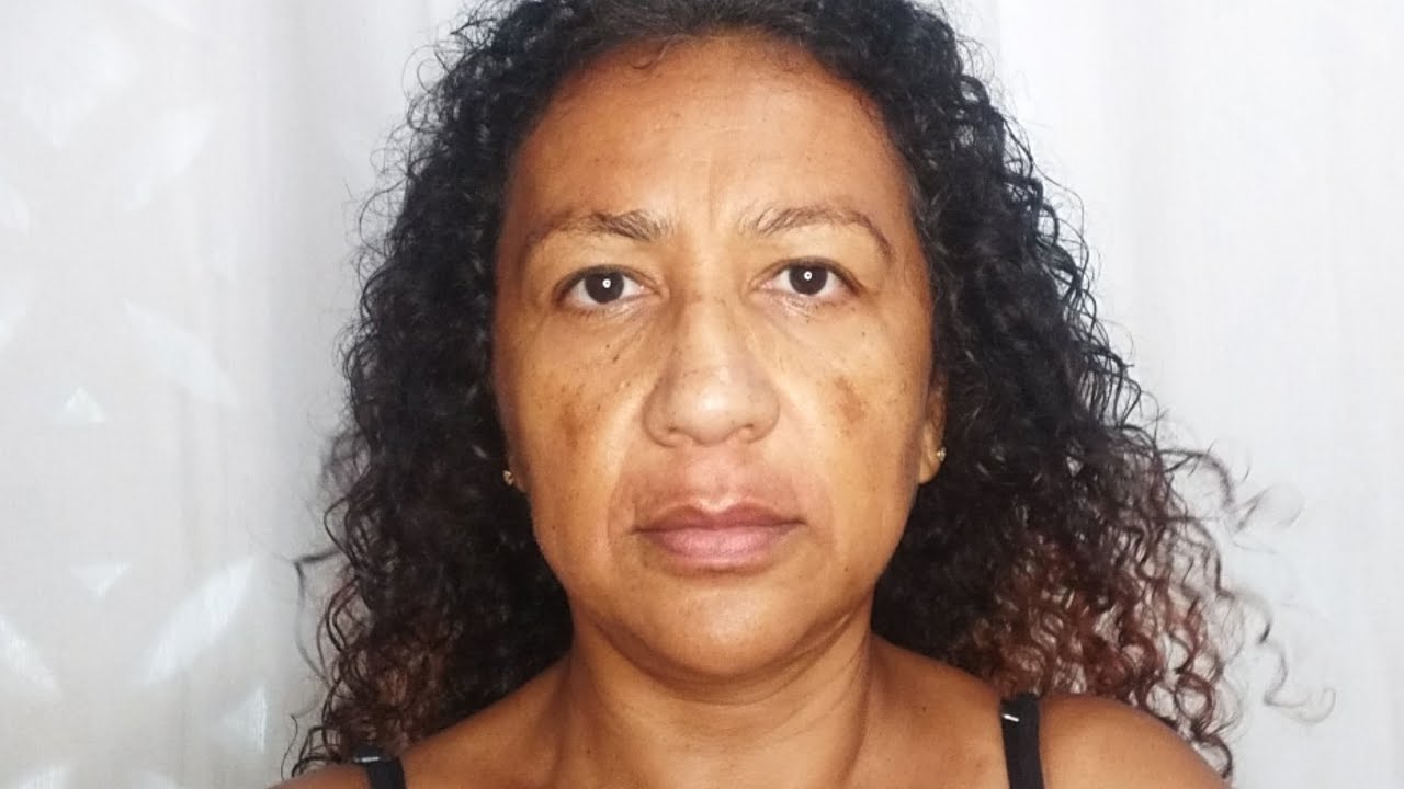MAQUIANDO CLIENTE - PELE MADURA COM MELASMA