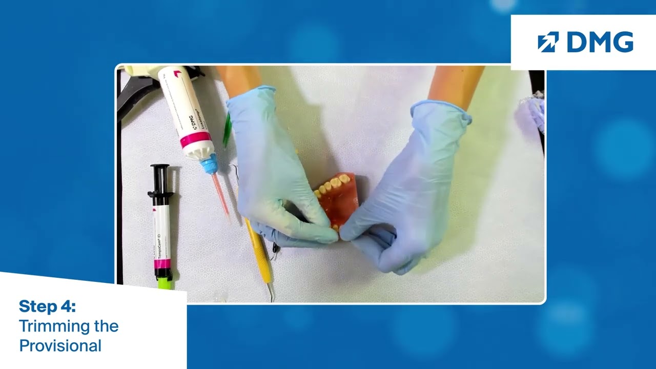 Clinical Provisional Crown and Bridge Workflow: Step 4, Trimming the Provisional