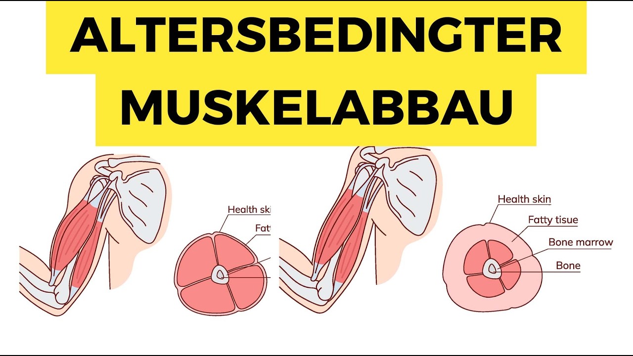 Warum Muskelmasse der Schlüssel zu einem langen Leben ist