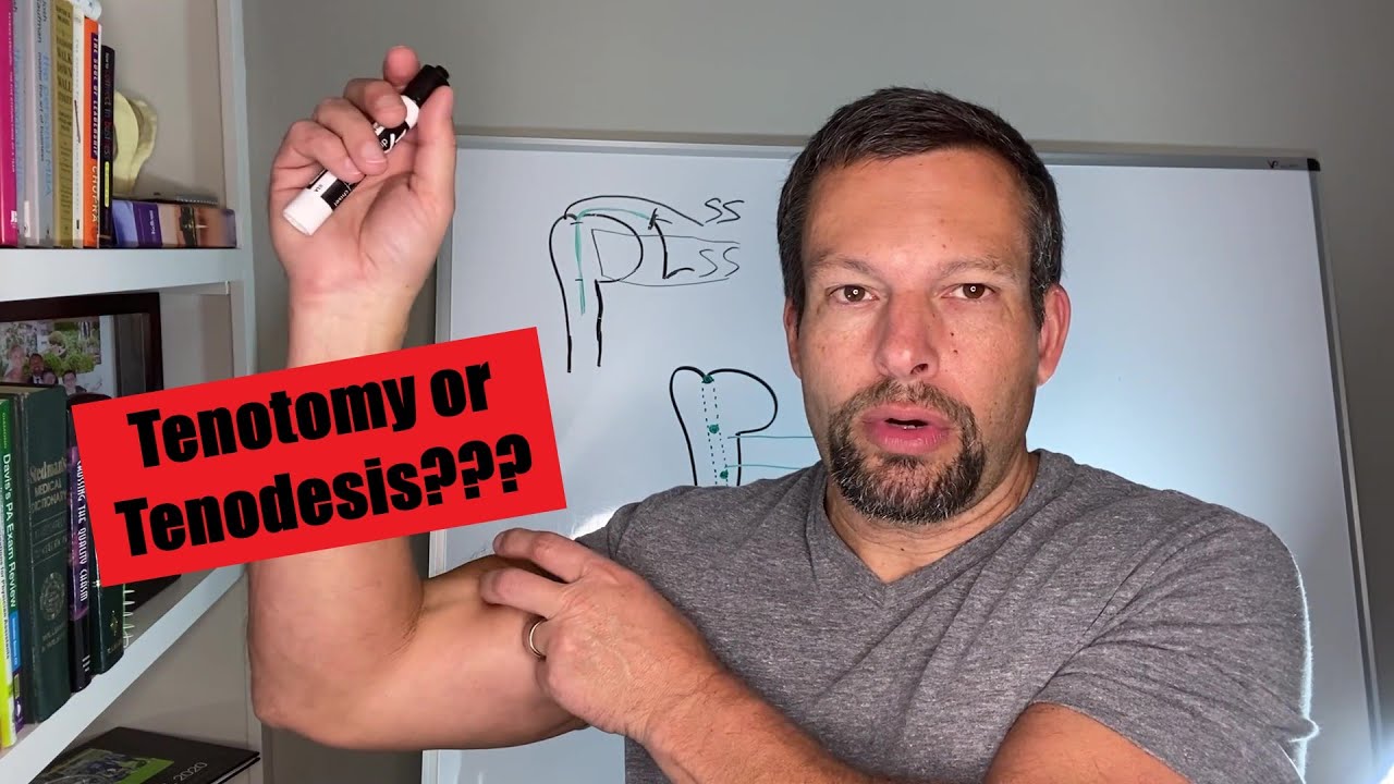Biceps Tenodesis vs Tenotomy: How & Why We Treat the Biceps in Shoulder Surgery