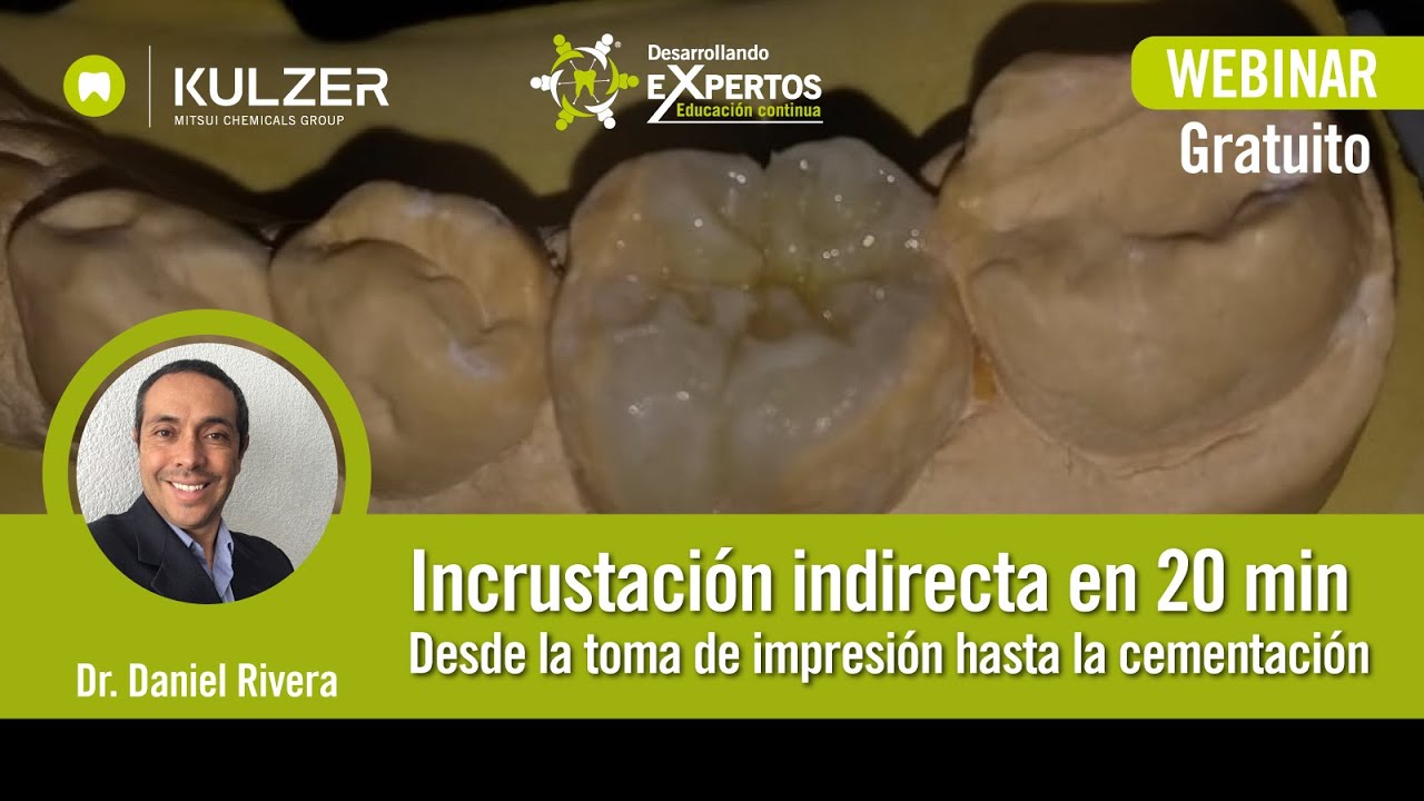 Desarrollando eXpertos - Incrustación indirecta en 20 min