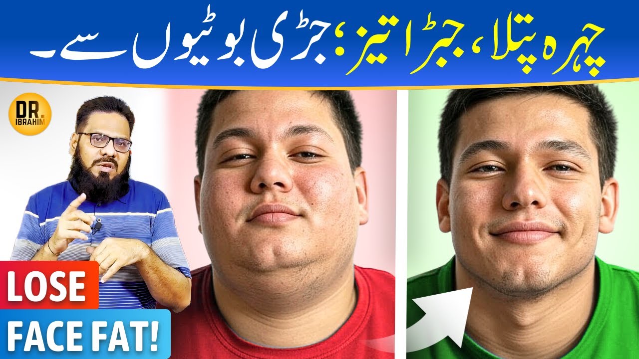 Face Fat Burn Karne Ka Tarika | Thirphala Remedy For Face Fat | Dr. Ibrahim