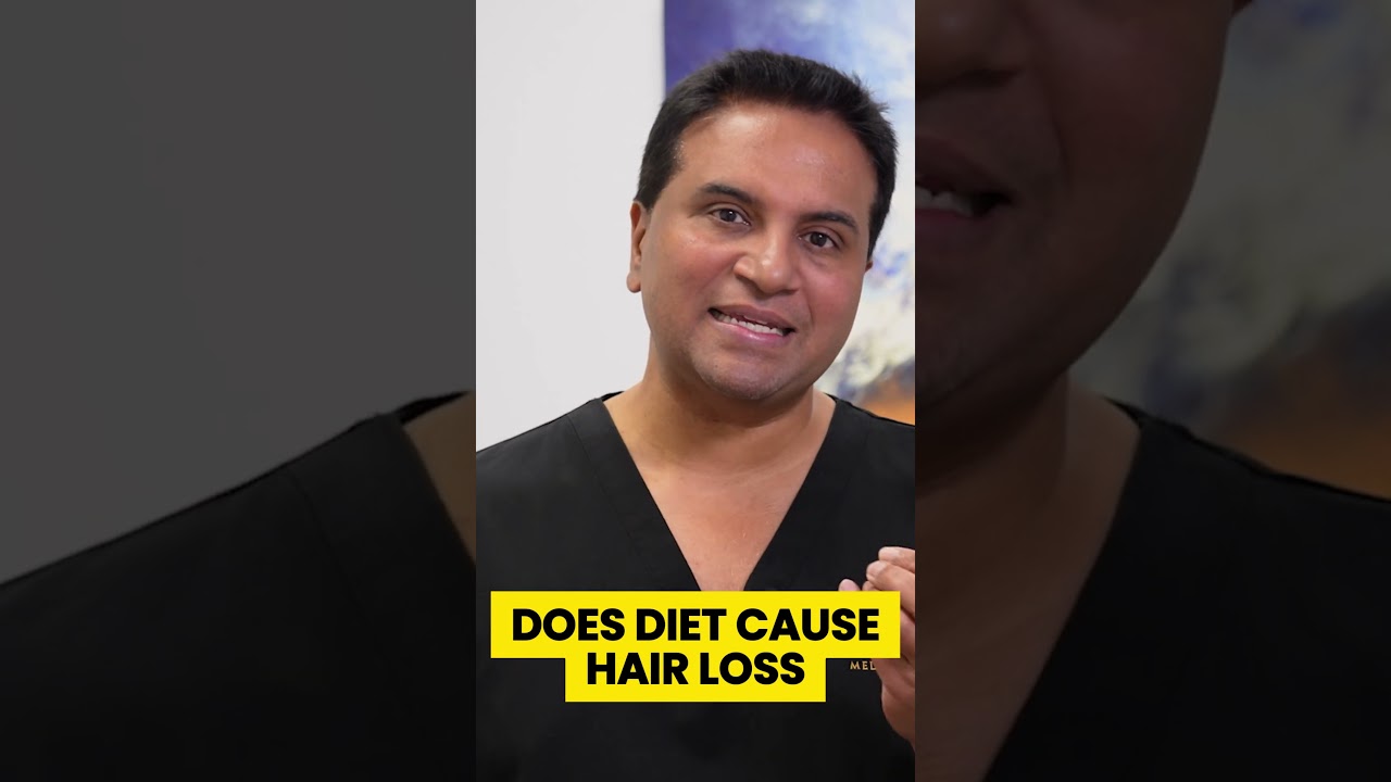 Does dieting cause hair loss?