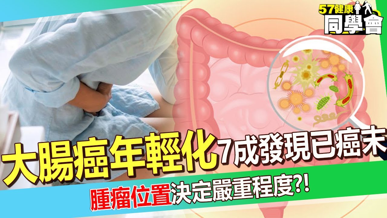 【精選】大腸癌年輕化「50歲以下病患暴增三成」？！ 腫瘤位置決定「嚴重程度」7成發現已是癌末？！   【57健康同學會】 @57healthy