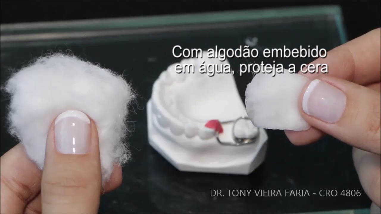 Mantenedor de espaço