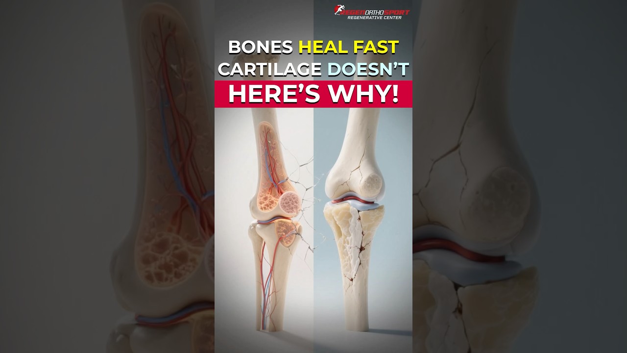 PRP or Stem Cells? The Right Fix for Tendons vs Cartilage