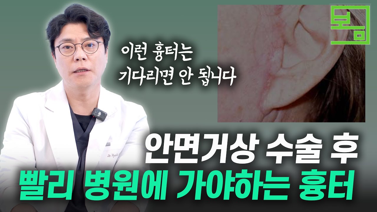 안면거상 흉터, 이런 흉터가 생기면 빨리 병원에 가세요