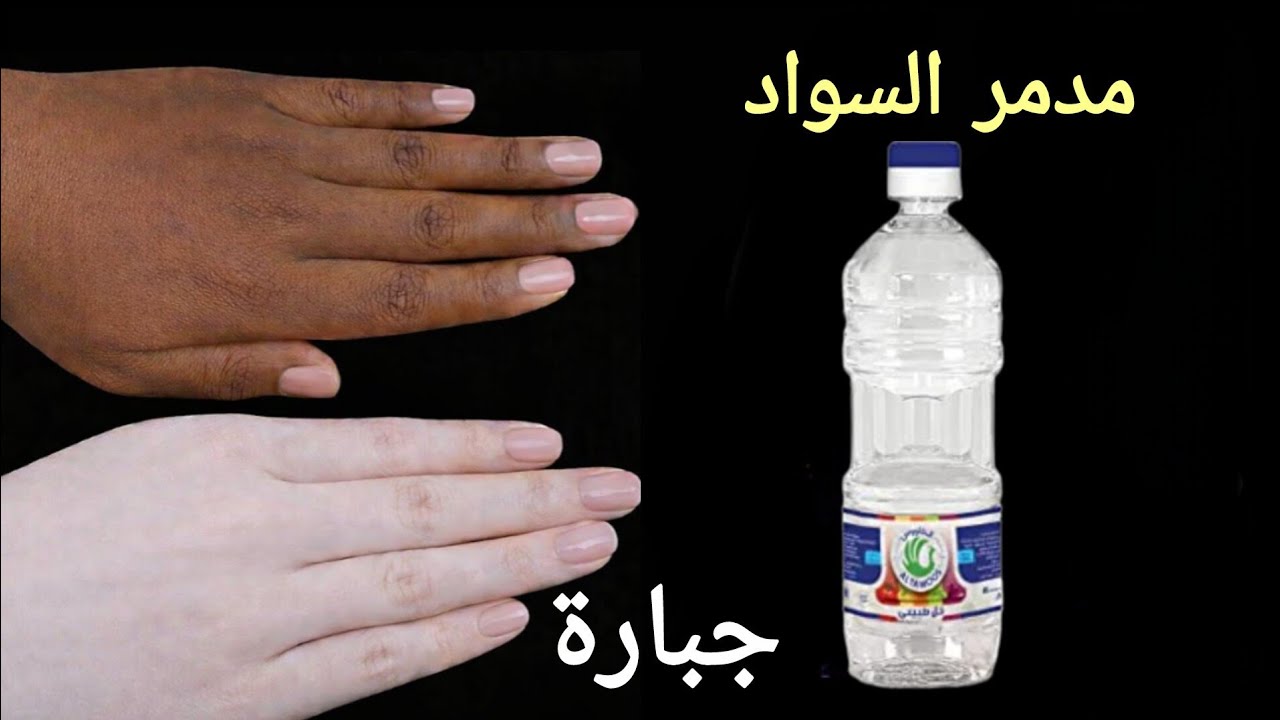 معلقة خل‼️ ضعيها على يدك والسواد ولن تصدقي النتيجة ‼️ تبييض اليدين فوري من اول استخدام مجربة ‼️