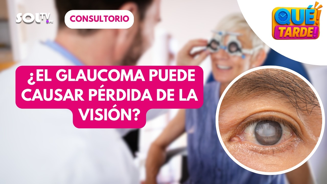 🧠👁️ ¿CUÁLES SON LOS SÍNTOMAS DEL GLAUCOMA? | QUE TARDE SOL TV