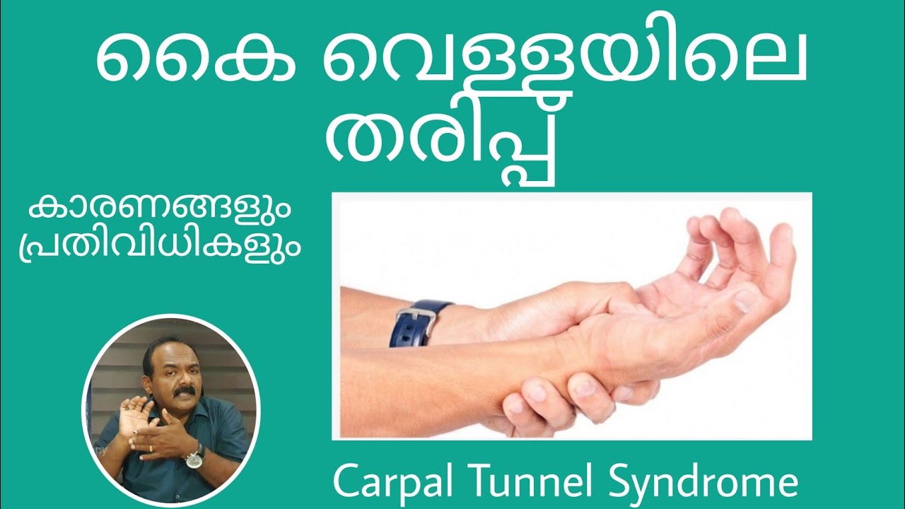 കൈ വെള്ളയിലെ തരിപ്പ്  പ്രതിവിധികൾ |Carpal Tunnel Syndrome |Exercises @Chitra Physiotherapy