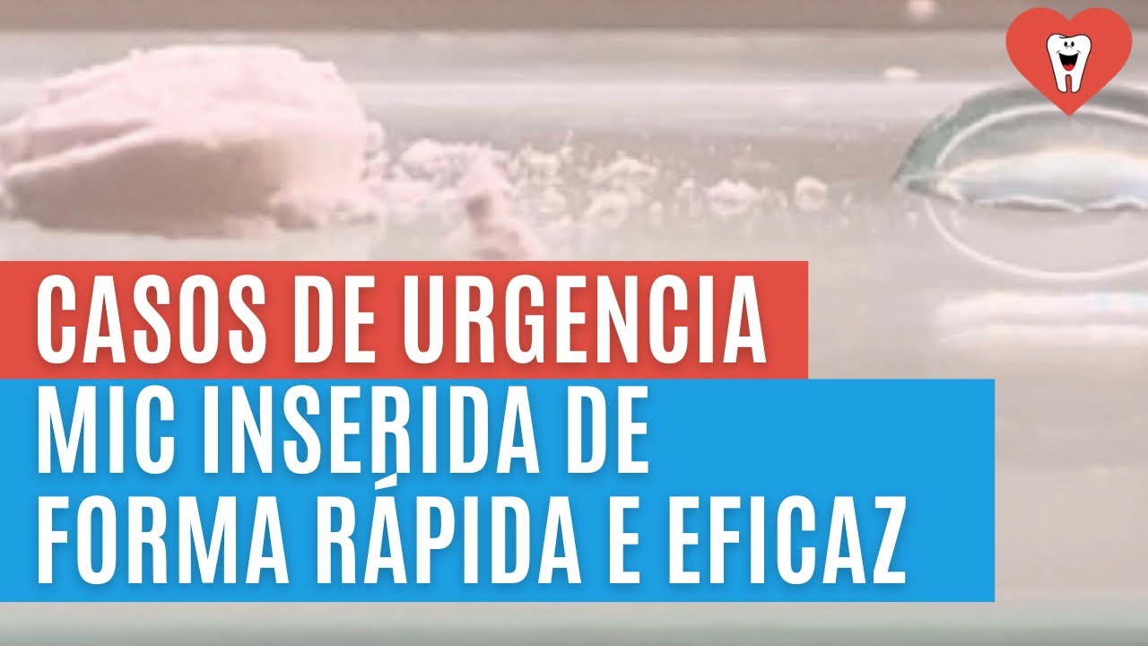 EM CASOS DE URGÊNCIA, COMO INSERIR ESSA MEDICAÇÃO INTRACANAL DE FORMA RÁPIDA E EFICAZ?