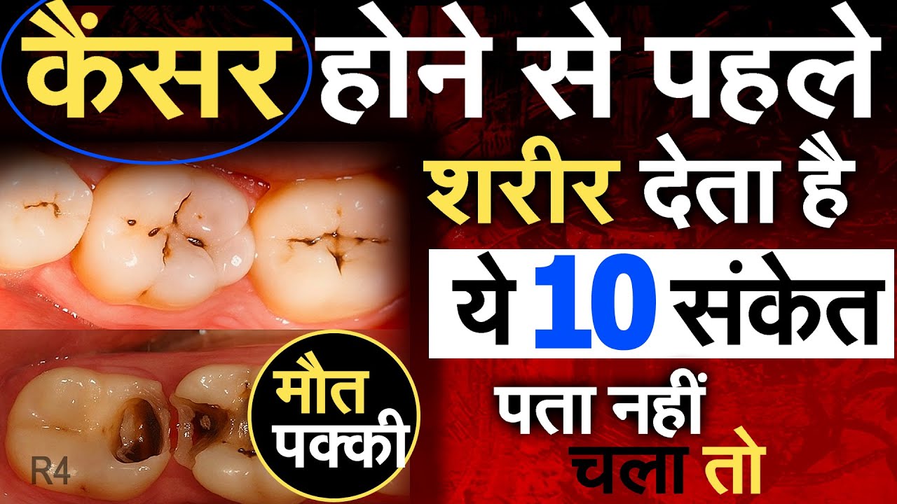कैंसर होने से पहले शरीर देता है ये 10 संकेत पता नहीं चला तो घातक | देख लें कहीं देर ना हो जाए R4