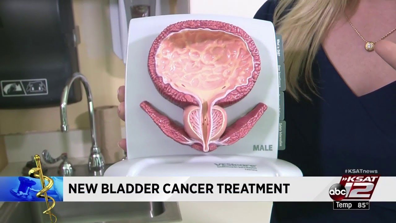 Video: One-time chemotherapy treatment drops bladder cancer recurrence significantly