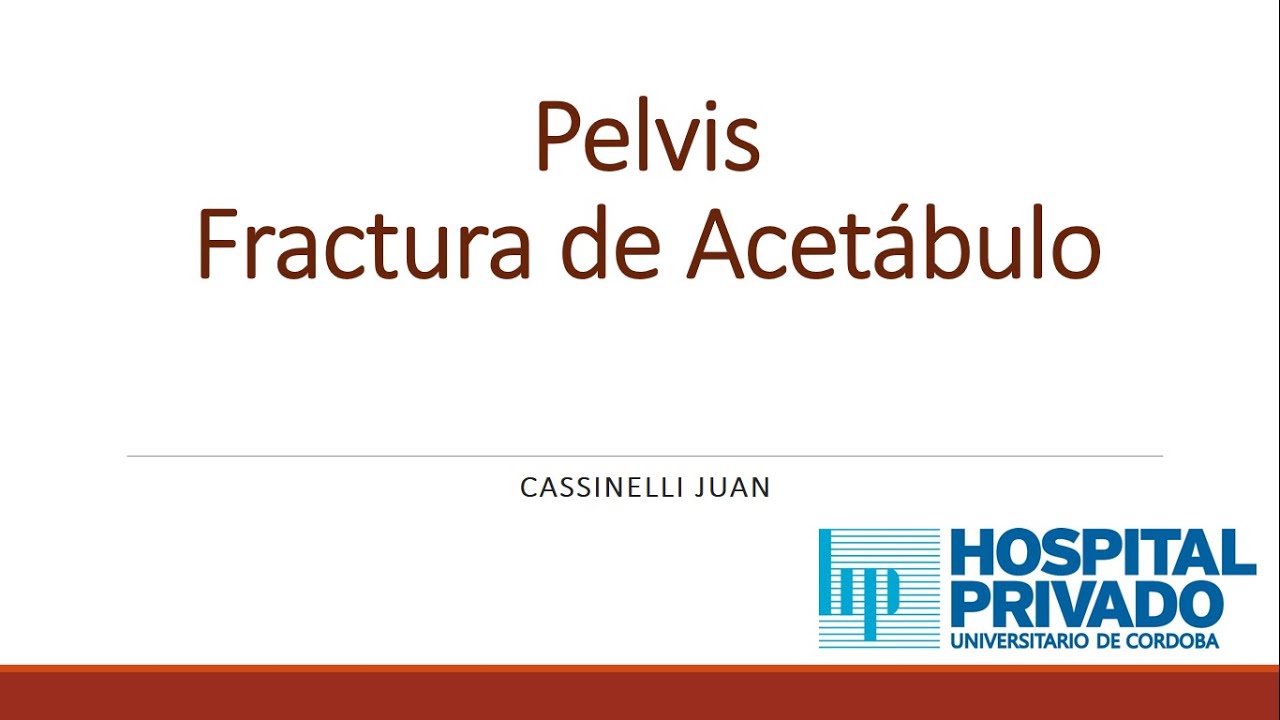 Pelvis: Fractura de acetábulo.