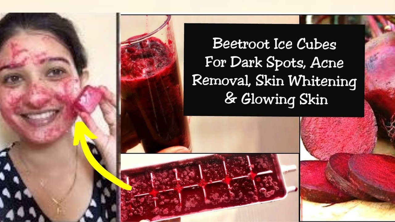 Dark spots removal | vegetable and Beetroot Ice cubes for dark spots | Remove Dark spots naturally