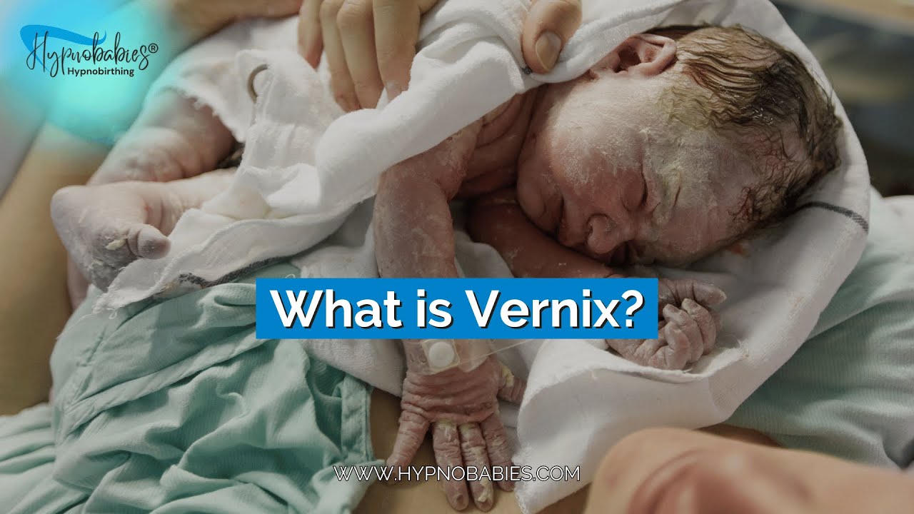 What is Vernix?