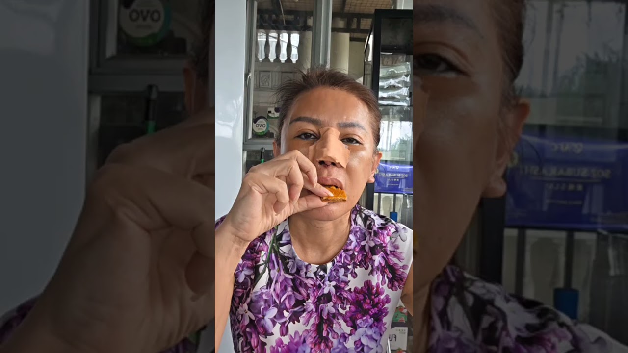 Hari Keempat Habis Op, Makin Bengkak Gak? Cik Mehong Ngemil Sambil Jawab Begini