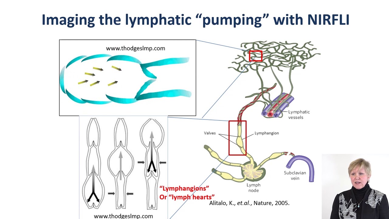 Dr. Sevick  Webinar: Imaging Lymphatic Function Dysfunction and Treatment