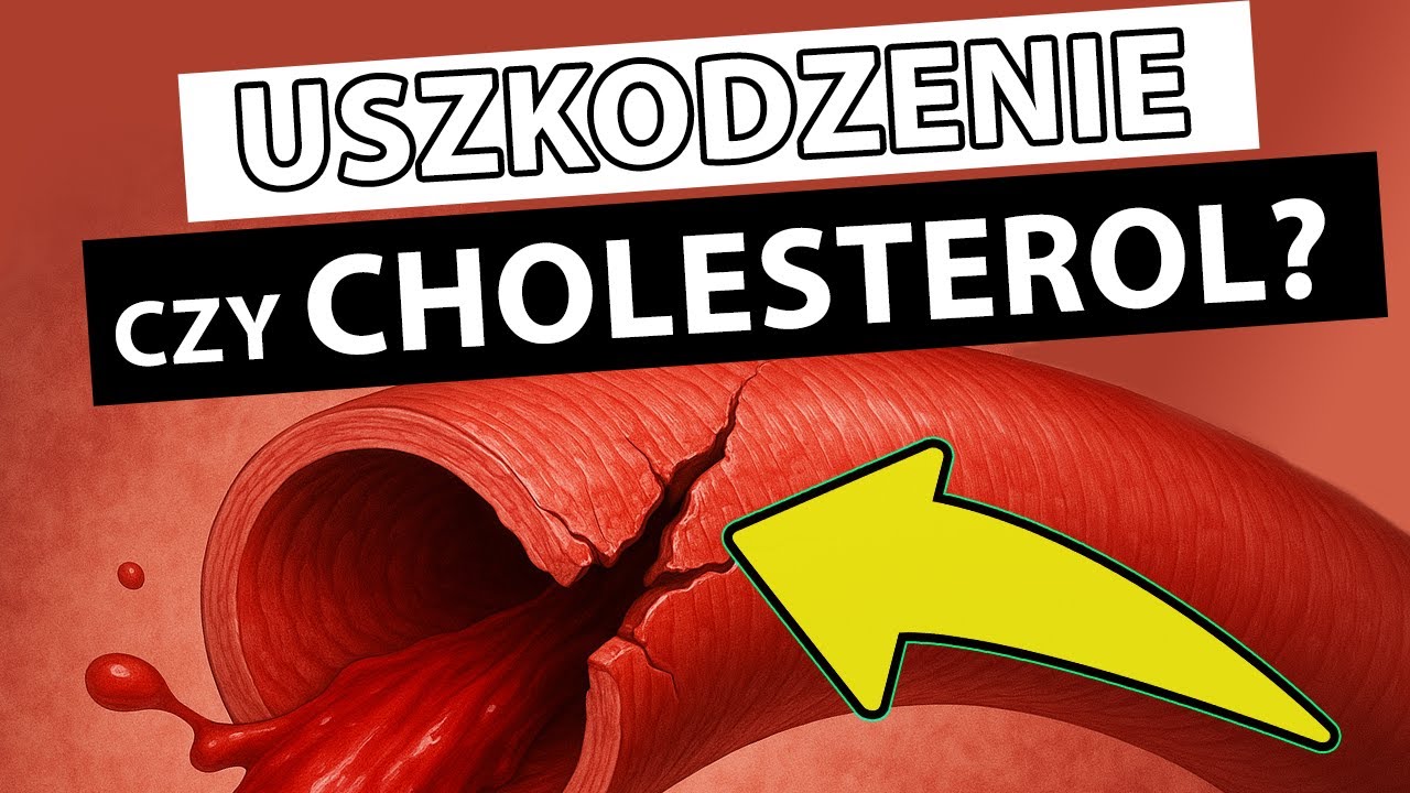 Czy cholesterol odkłada się w NIEUSZKODZONYCH naczyniach? Retencja | Dawid Dobropolski