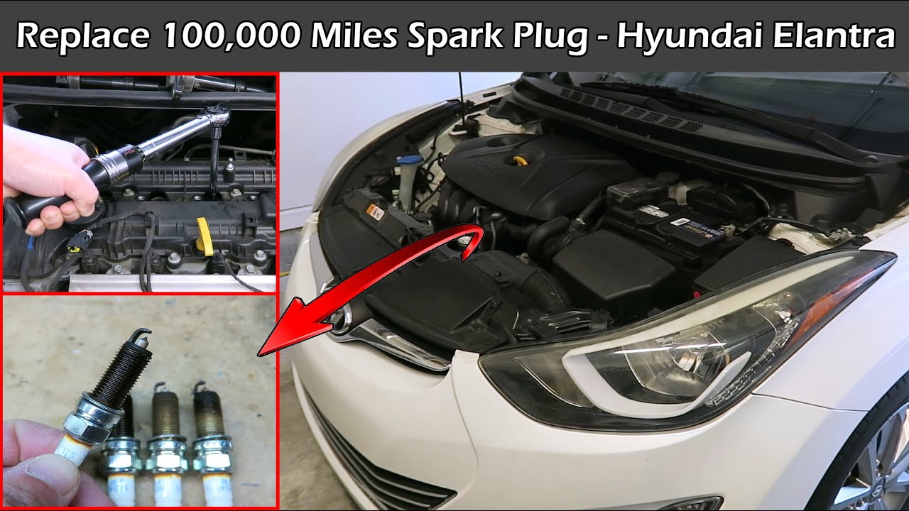 Замена свечей зажигания на 100 000 миль | NGK Iridium | Hyundai Elantra