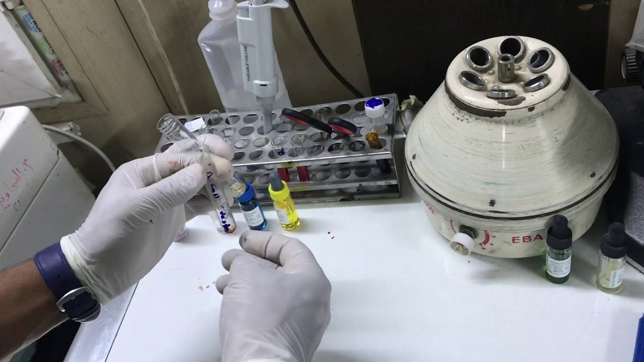 طريقة التيوب ( الطريقه العكسيه) الجزء الثاني