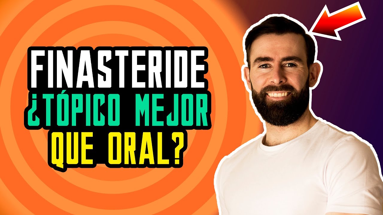 Finasteride Oral Vs T&oacute;pico Para La Alopecia