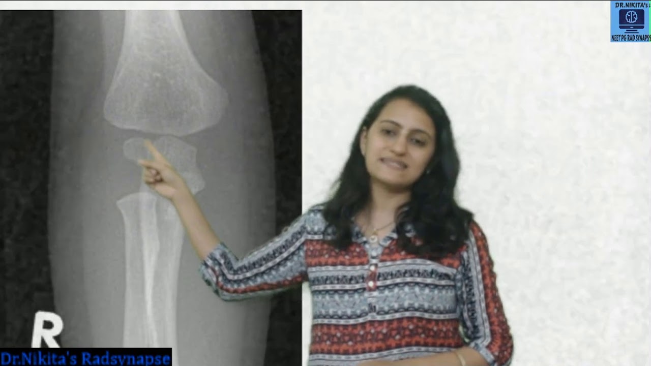 Ossification centres - Elbow and their clinical application |NEETPG|AIIMS|Dr. Nikita Nanwani