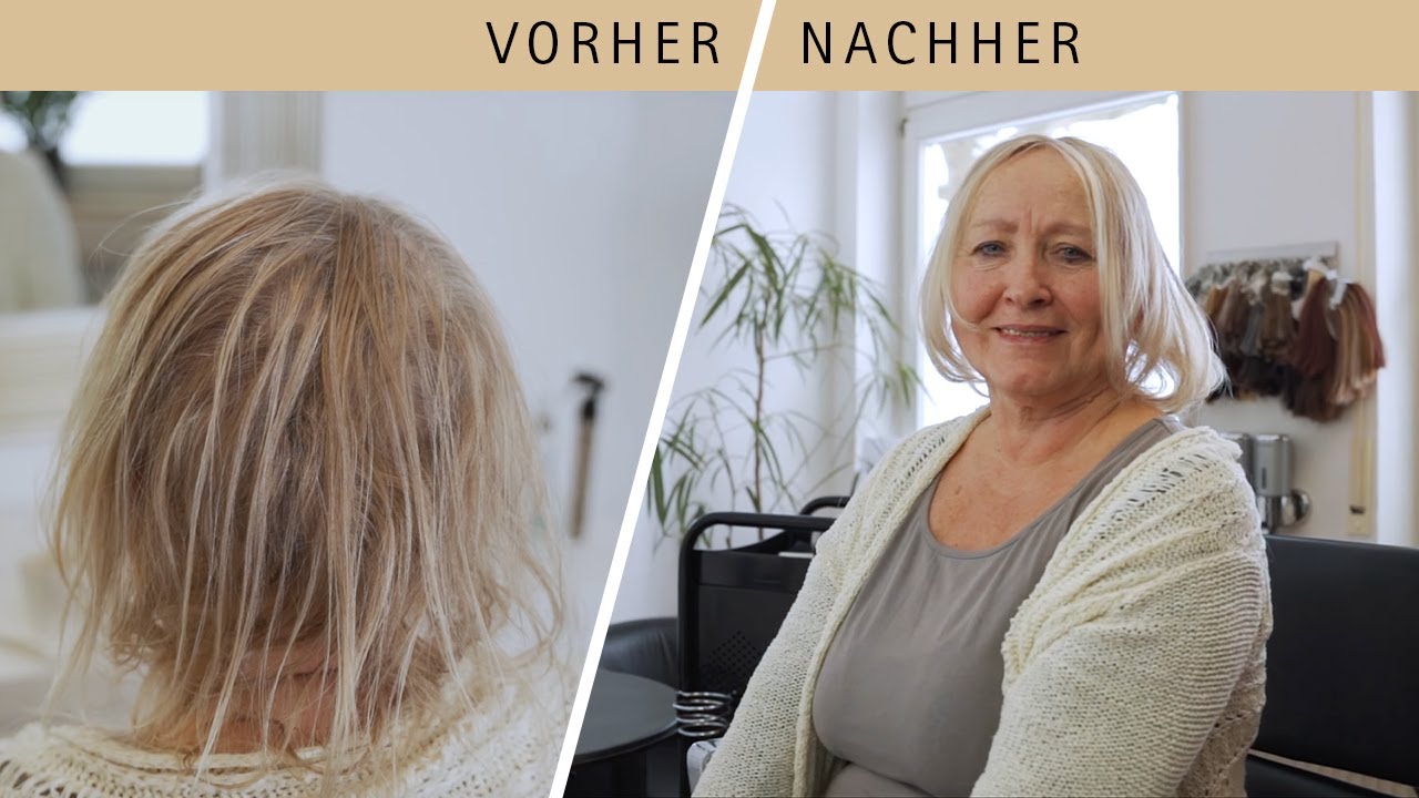 Endlich wieder volles Haar mit einem Haarsystem | Hairsystem transformation