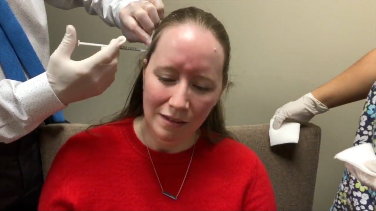 Migraine Neurologist Appointment & Botox for Migraine