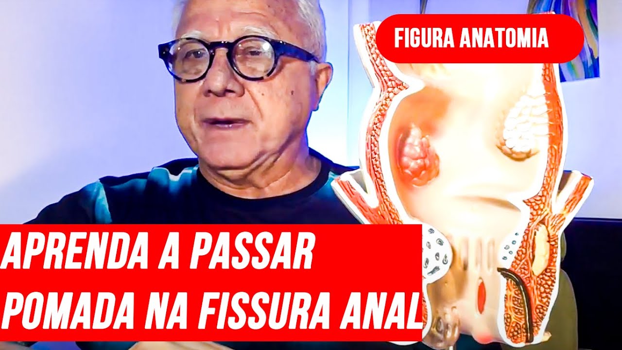 Fissura:Aprendam passar pomada manipulação fissura anal certa no local certo e seu efeito colateral.