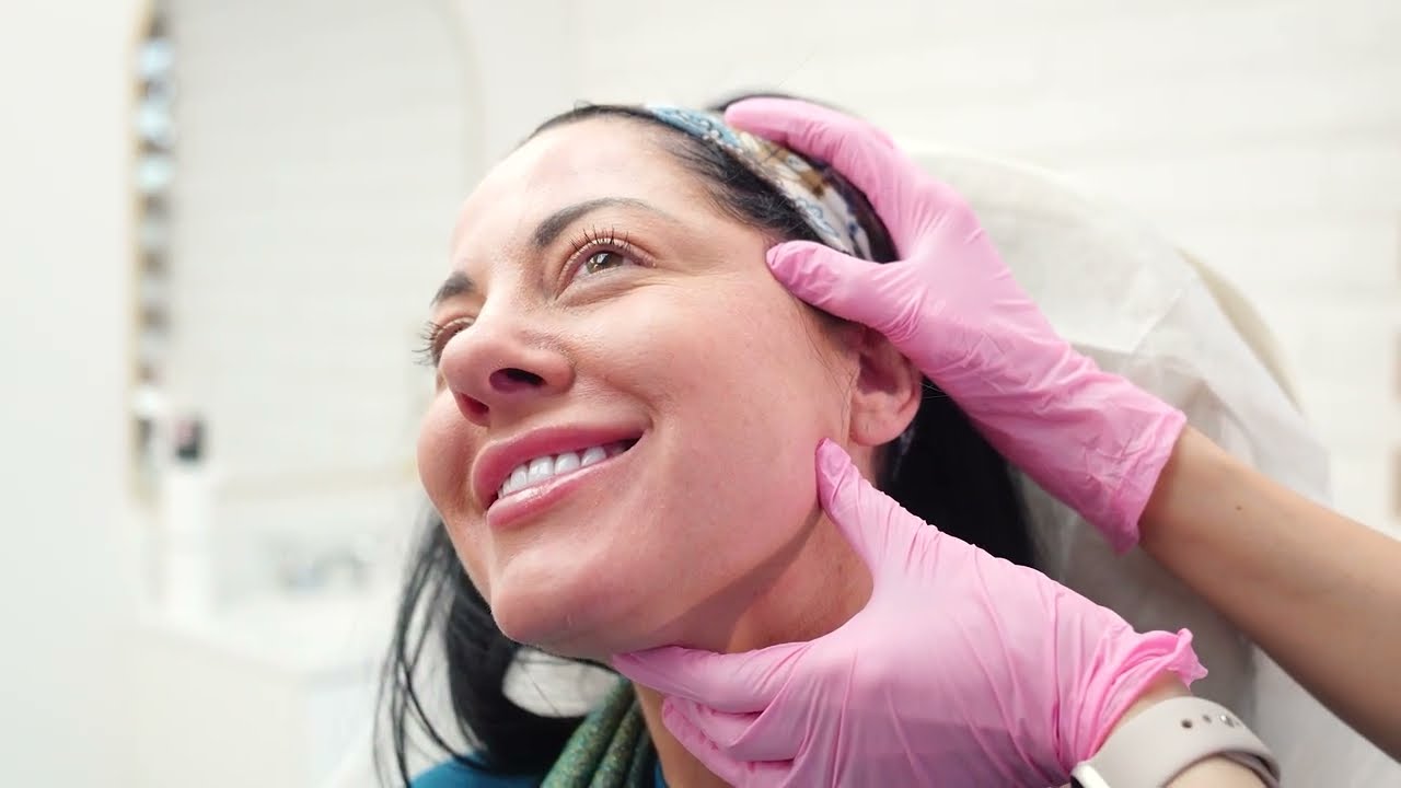 Thread Lift Experience in San Jose, CA | Non-Surgical Face Lift at VitaGlowMD