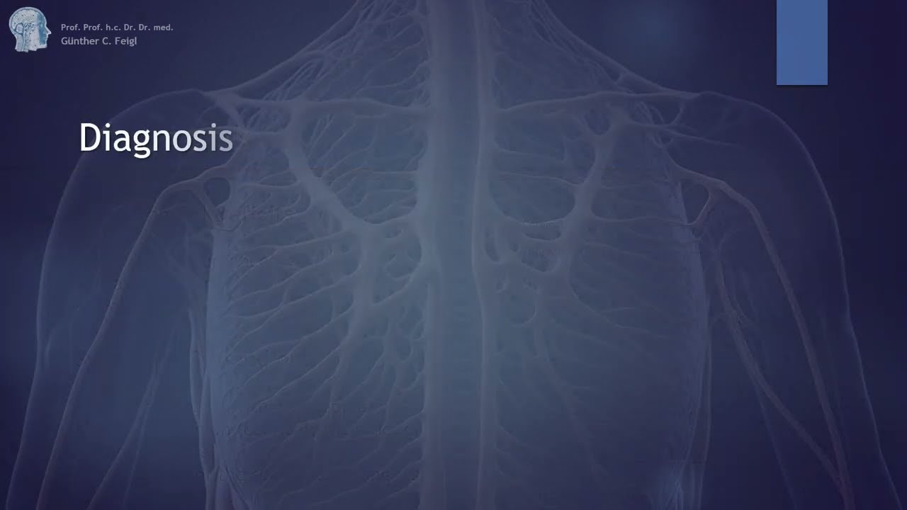 Briefly explained: Spinal Cord Tumors
