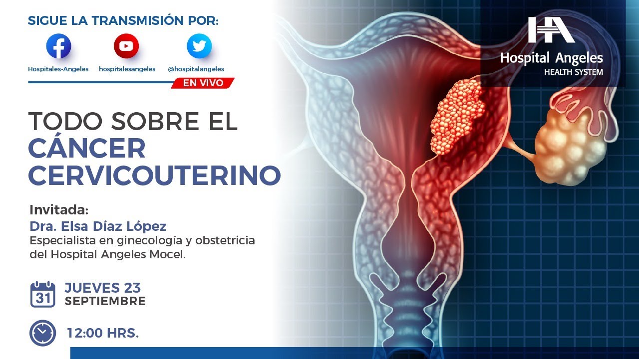 Todo sobre el cáncer cervicouterino
