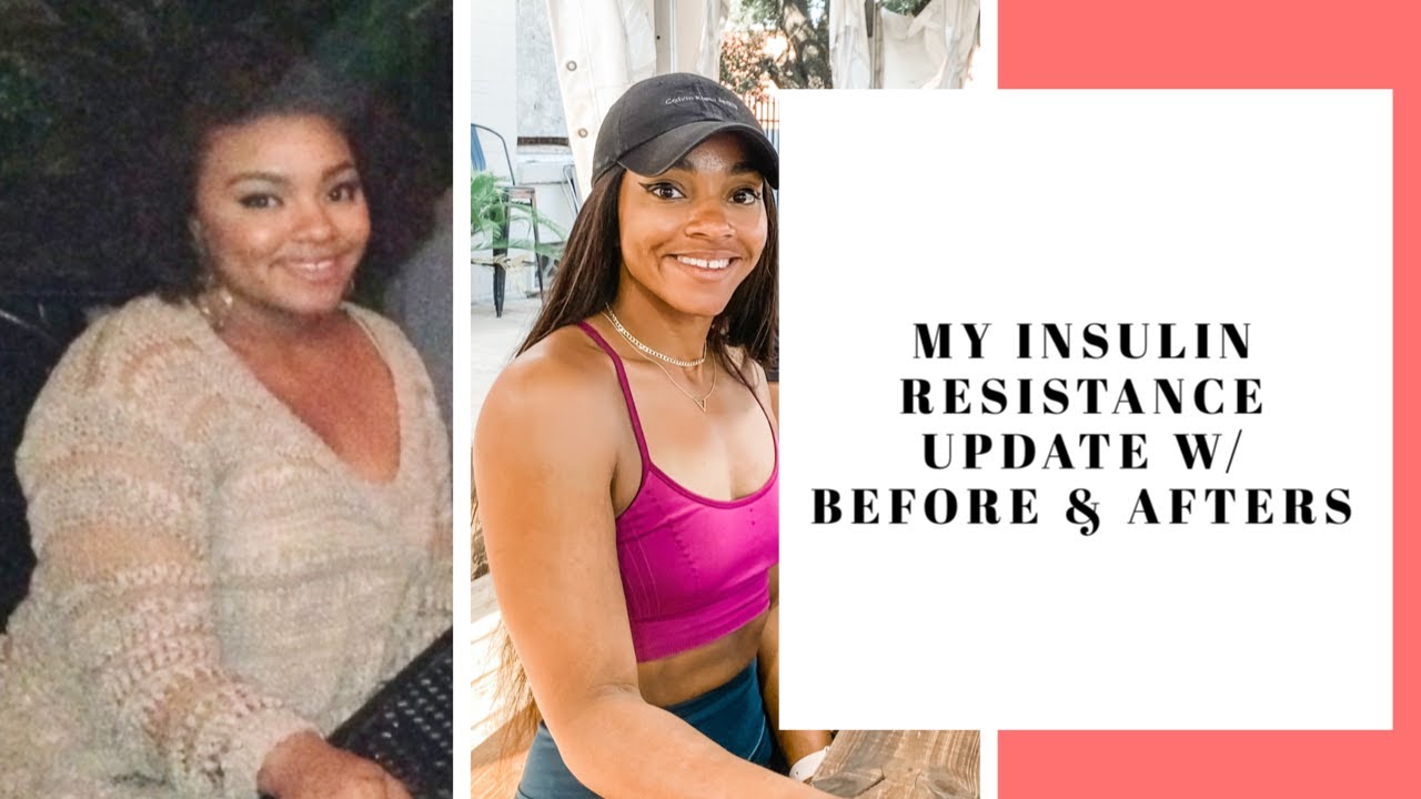 My Insulin Resistance UPDATE w/ Before and After Pictures!