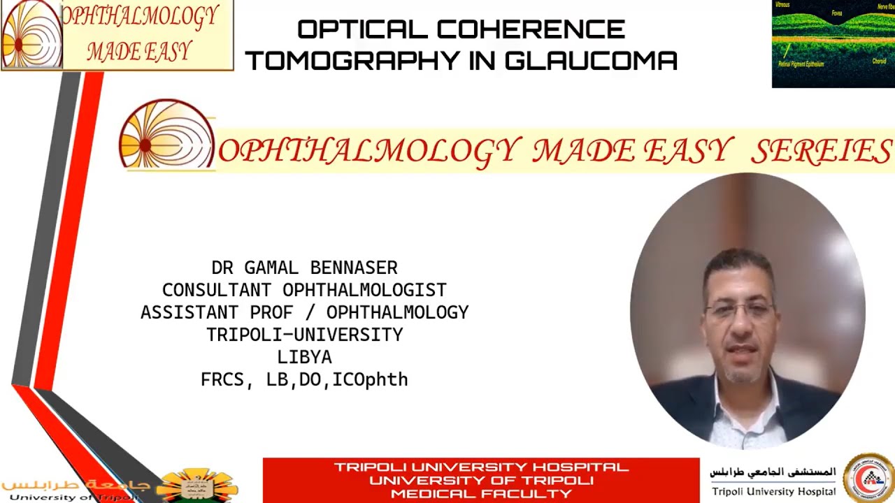 OPTICAL COHERENCE TOMOGRAPHY (OCT) IN GLAUCOMA  1