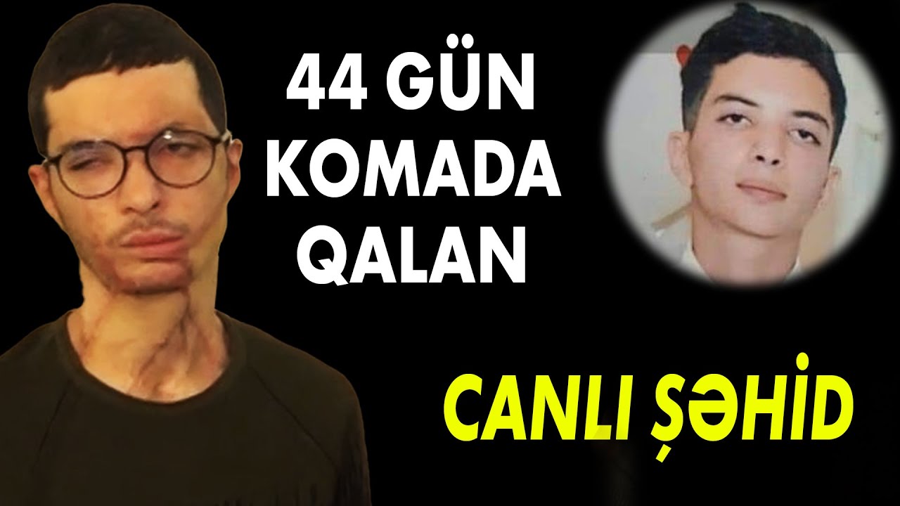 Müharibədə Yanında Raket Partladı , Tanınmaz Hala Düşdü - Canlı Şəhid  | Baku TV