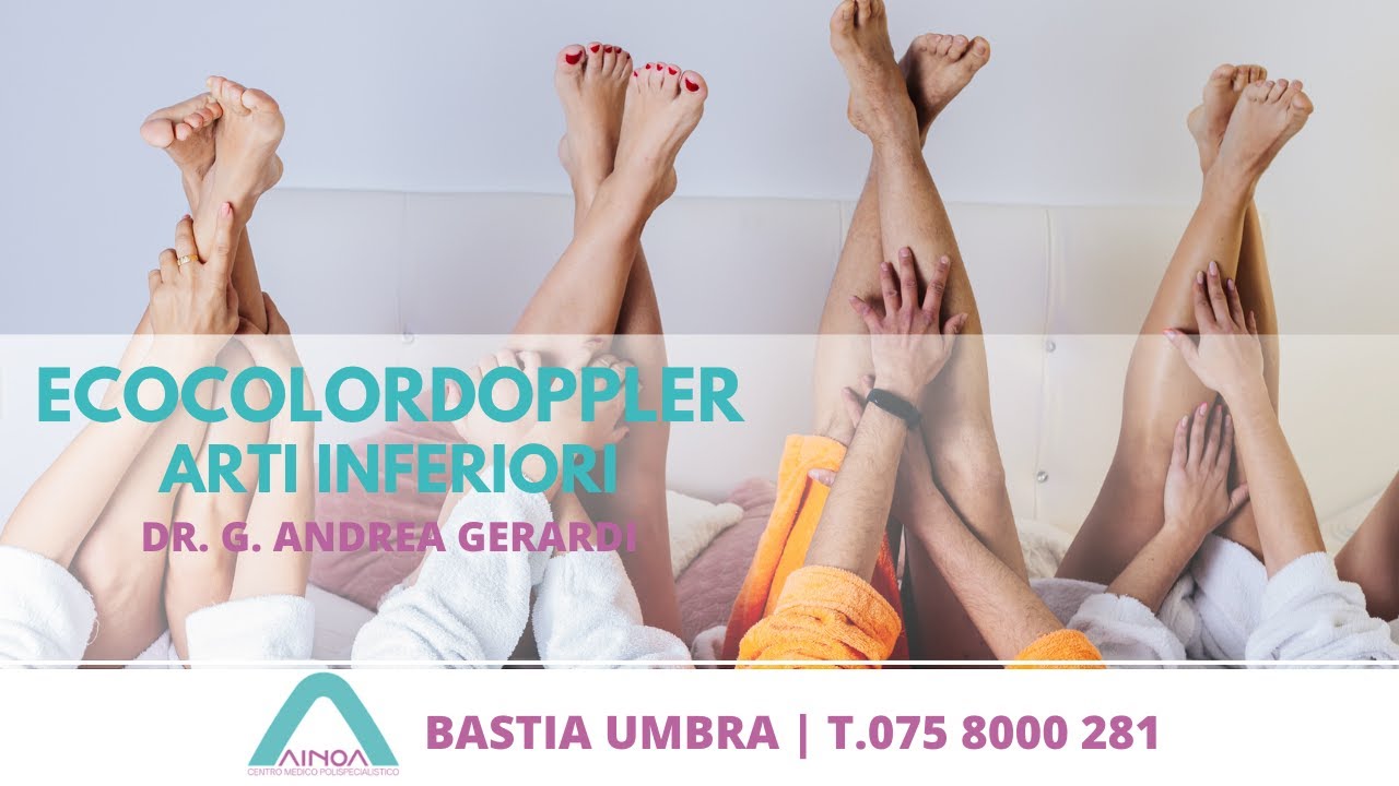 Ecocolordoppler Arti Inferiori || Dr. G. Andrea Gerardi