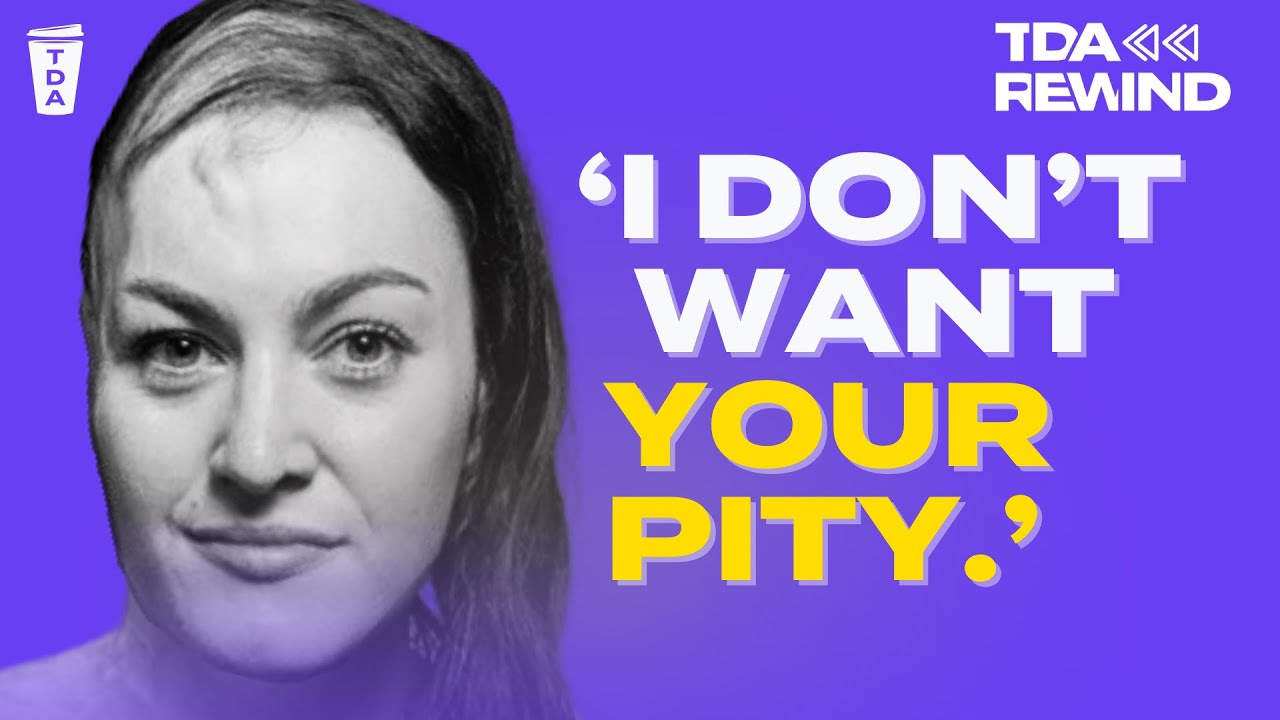 Stop Labelling Sophie Delezio As An Inspiration | The Daily Aus