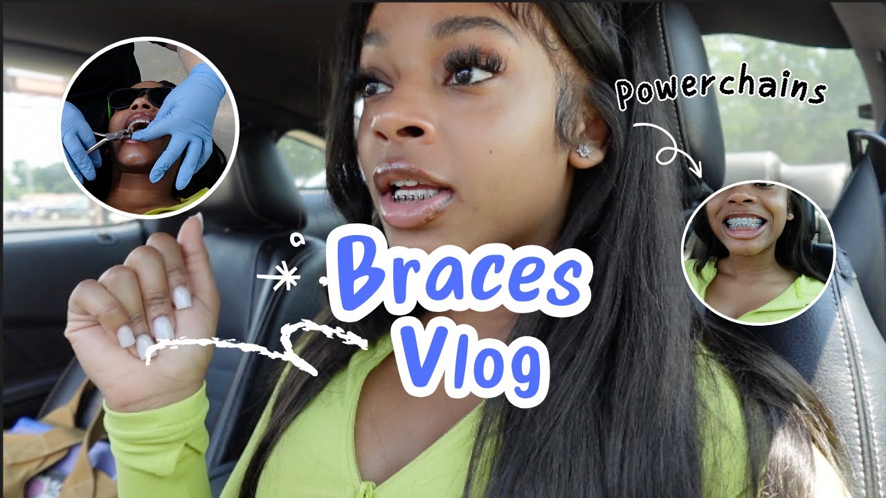 BRACES VLOG | I GOT POWER CHAINS 😁 *THEY HURT SO BAD*