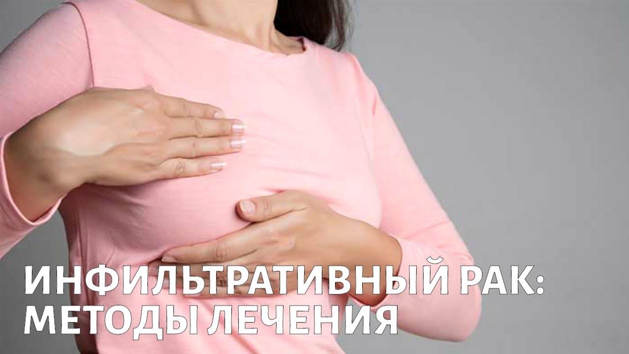 Инфильтративный рак груди: диагностика, методы лечения, реабилитация
