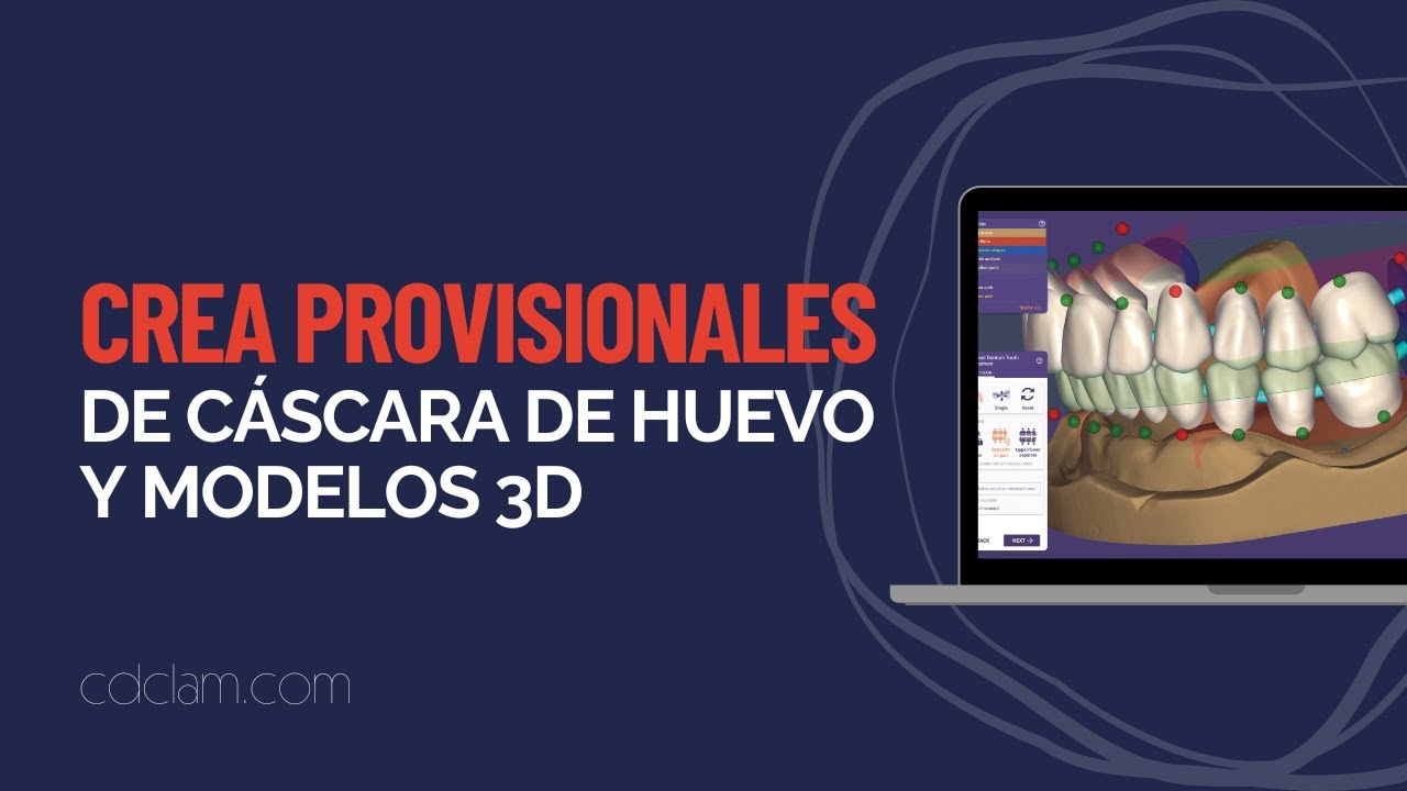 ¡Crea Provisionales de Cáscara de Huevo y Modelos 3D adaptados a tu diseño como un PRO EXOCAD!