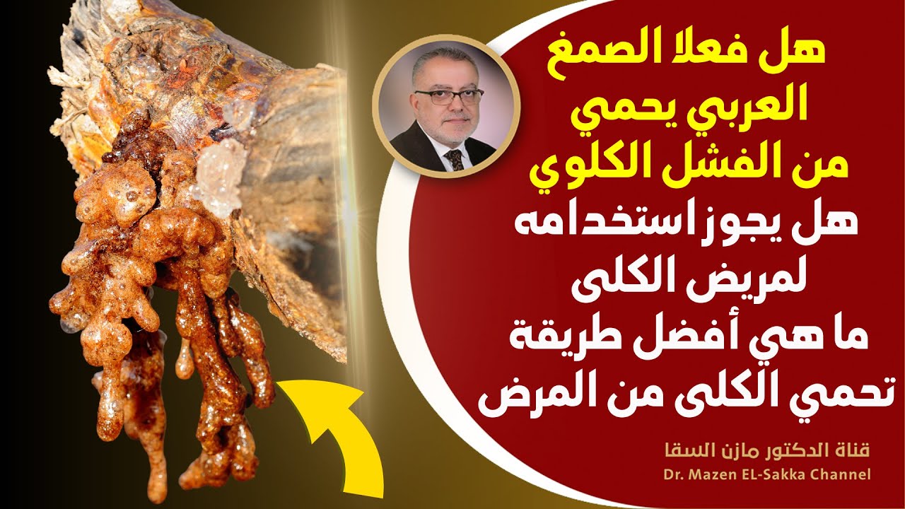 هل فعلا الصمغ العربي يحمي من الفشل الكلوي؟ وما أفضل طريقة لحماية الكلى للأبد أنشروها جزاكم الله خيرا