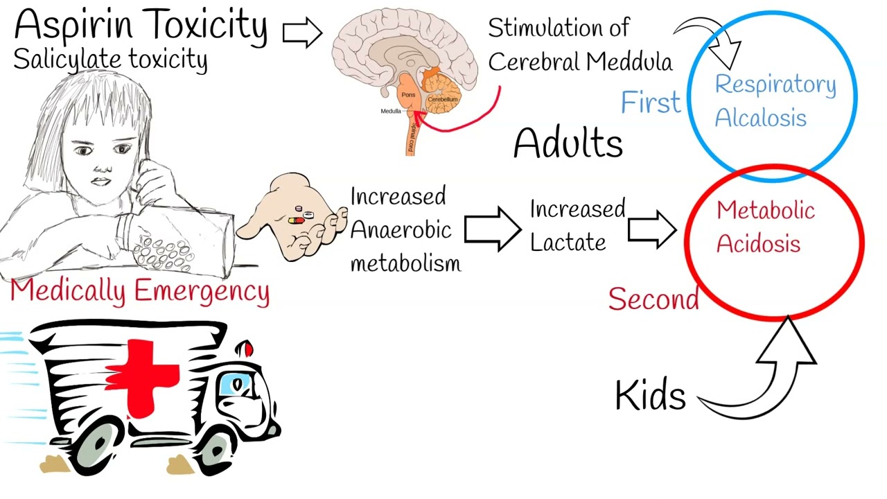 Child accidentally ingest aspirin - Salicylate toxicity
