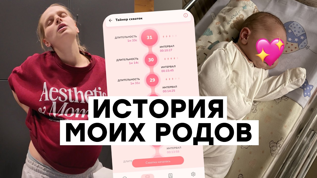 Что пошло не по плану? Моя история родов