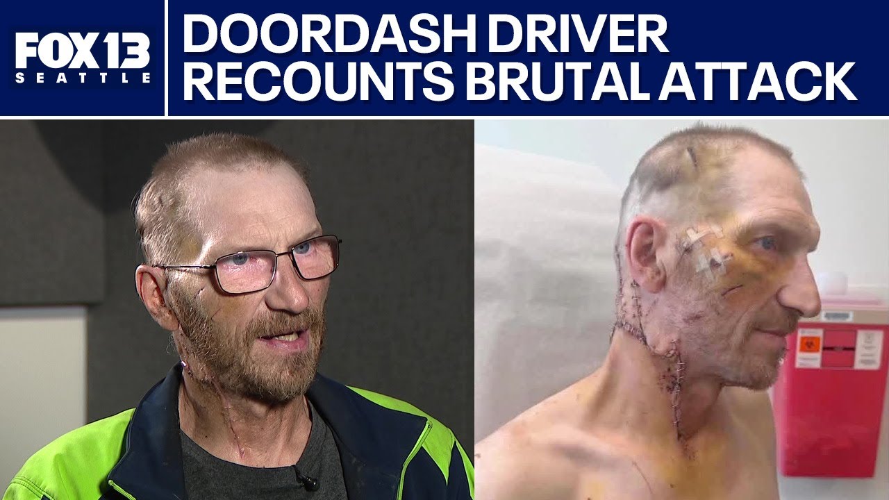 WA DoorDash driver recounts vicious attack | FOX 13 Seattle