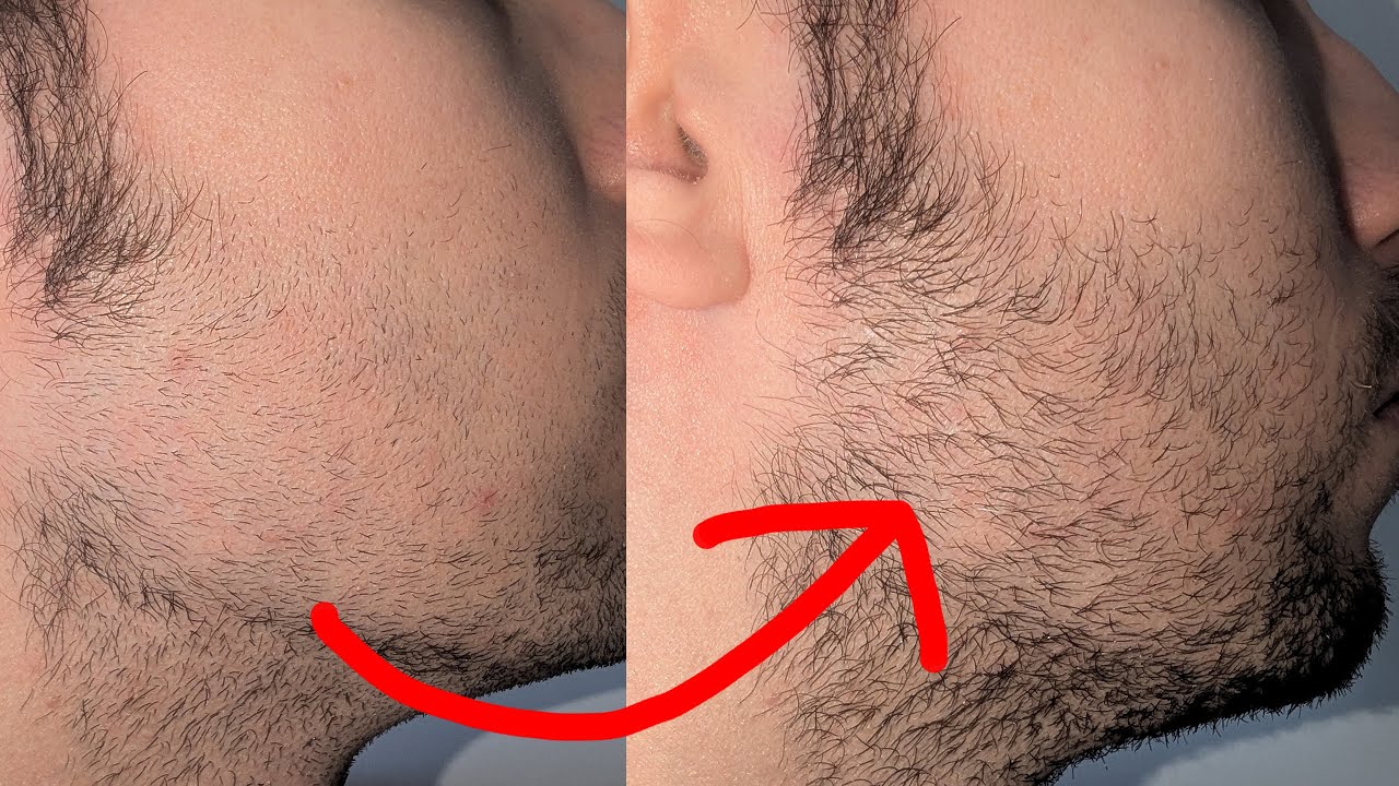 Las 7 maneras de MEJORAR tu BARBA