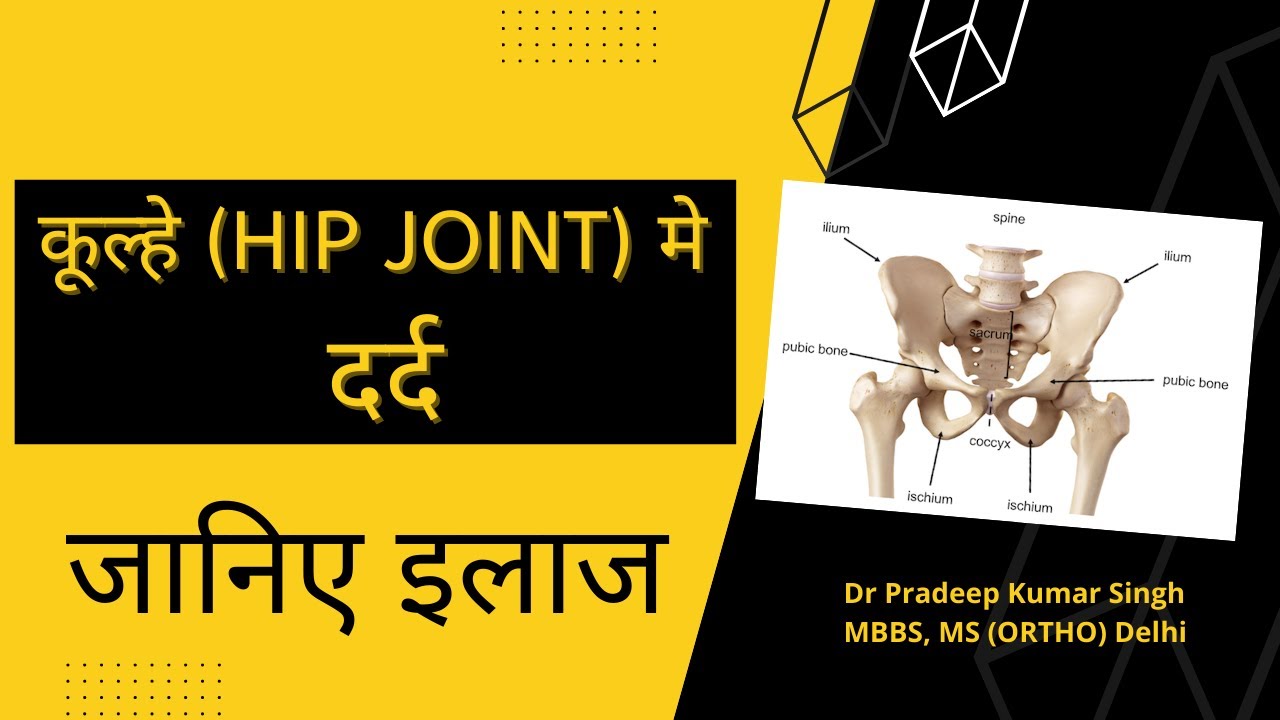 कूल्हे में दर्द का इलाज /Dr. Pradeep Kumar Singh