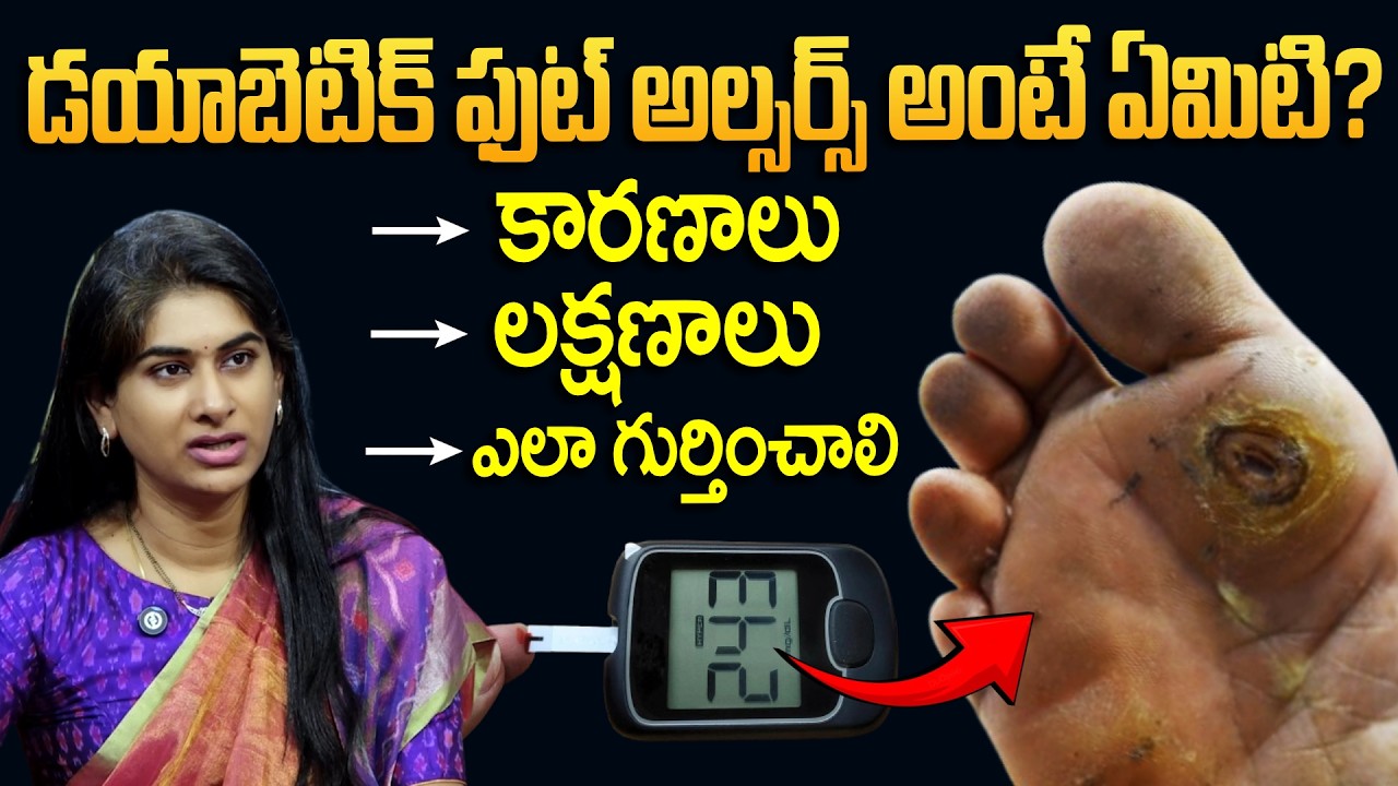 Must Watch | డయాబెటిక్ ఫుట్ అల్సర్స్ అంటే ఏమిటి? | Diabetic Foot Ulcers | High Diabetes Symptoms