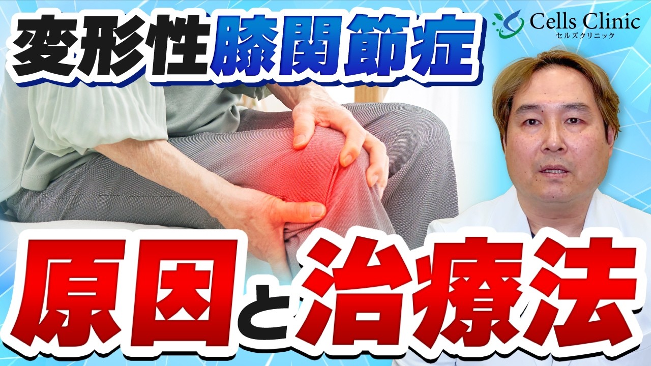 変形性膝関節症とは？膝が痛くなる理由と治療法を整形外科医が解説