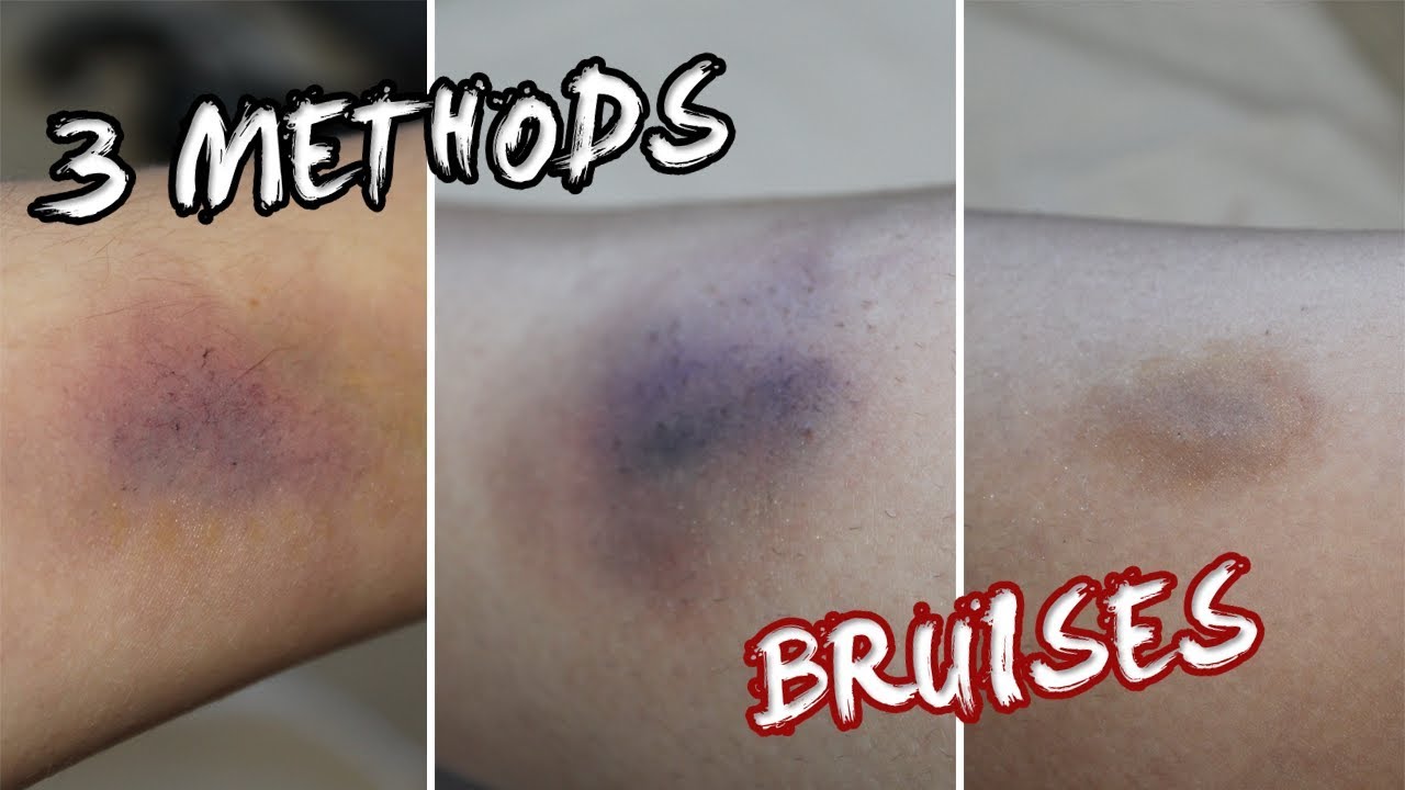 Easy Fake Bruises | 3 Methods
